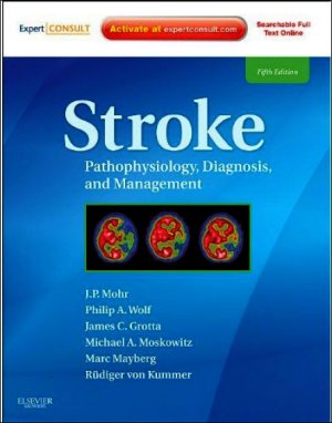 Mohr J.P. Stroke - Pathophysiology, Diagnosis, and Management