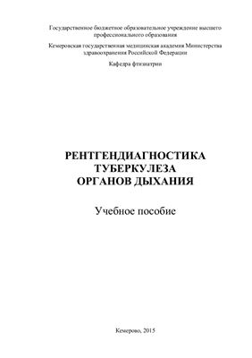 Кобелева Г.В., Копылова И.Ф. Рентгендиагностика туберкулеза органов