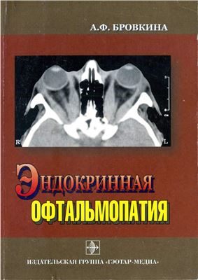 Бровкина А.Ф. Эндокринная офтальмопатия