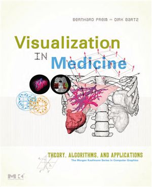 Preim B., Bartz D. Visualization in Medicine. Theory, Algorithms, and Applications