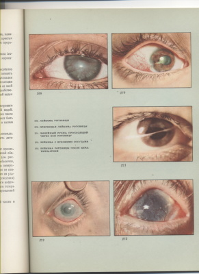 Раднот М. Атлас глазных болезней. В двух томах. Том 1