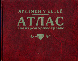 Школьникова М.А., Березницкая В.В., Термосесов С.А. и др. Аритмии у детей. Атлас электрокардиограмм