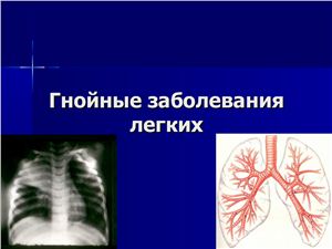 Гнойные заболевания лёгких