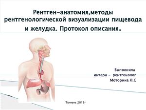 Рентген-анатомия и методы визуализации желудка и пищевода