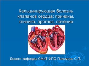 Кальцинирующая болезнь клапанов сердца: причины, клиника, прогноз, лечение