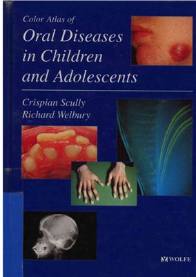 Scully Crispian, Welbury Richard. Color Atlas of Oral Diseases in Children and Adolescents