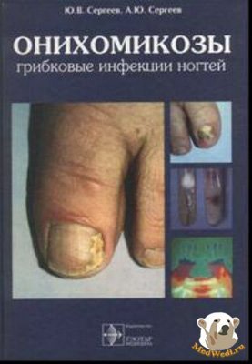 Сергеев Ю.В. Онихомикозы. Грибковые инфекции ногтей