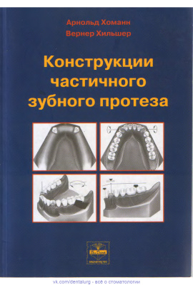 Хоманн А., Хильшер В. Конструкции частичного зубного протеза