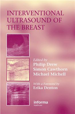Drew Philip. Interventional Ultrasound of the Breast