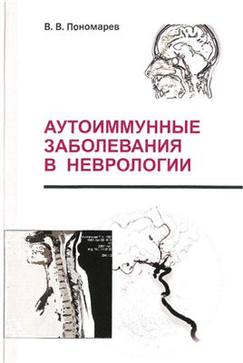 Пономарев В.В. Аутоимунные заболевания в неврологии