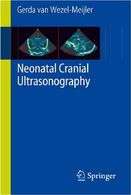 Wezel-Meijler G. Neonatal Cranial Ultrasonography Guidelines for the Procedure and Atlas of Normal Ultrasound Anatomy