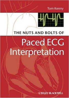Kenny T. The Nuts and bolts of Paced ECG Interpretation/ЭКГ при кардиостимуляции