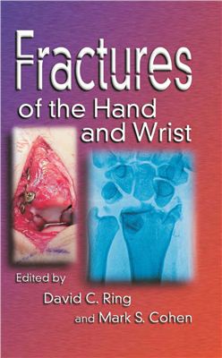 Ring David C., Cohen Mark S. Fractures of the hand and wrist