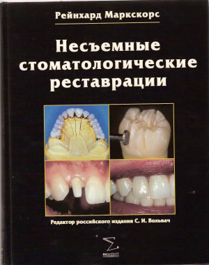 Маркскорс Р. Несъемные стоматологические реставрации