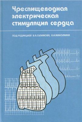 Сулимов В.А., Маколкин В.И. Чреспищеводная электрическая стимуляция сердца