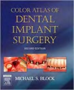 Block Michael S. Color Atlas of Dental Implant Surgery