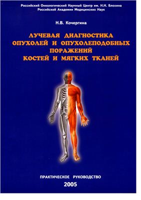 Кочергина Н.В. Лучевая диагностика опухолей и опухолеподобных поражений костей и мягких тканей