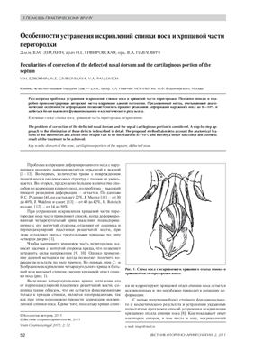 Вестник оториноларингологии 2011 №02