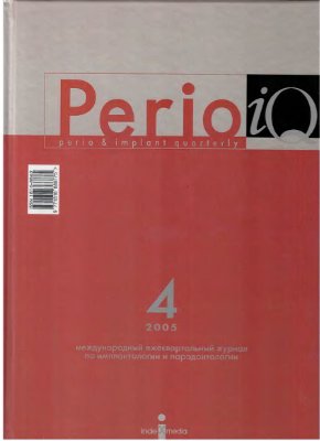 Perio iQ 2005 №04