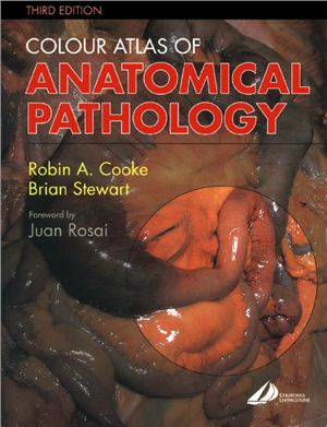 Cook R.A., Stewart B. Colour Atlas of Anatomical Pathology