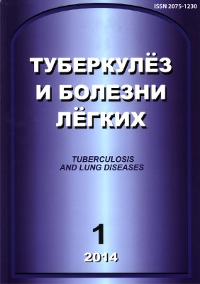 Туберкулез и болезни легких 2014 №01