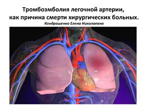 Тромбоэмболия легочной артерии, как причина смерти хирургических больных