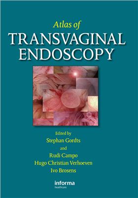 Stephan Gordts, Rudi Campo, Hugo Christian Verhoeven. Atlas of Transvaginal Endoscopy
