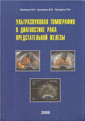 Шолохов В.Н., Бухаркин Б.В., Лепэдату П.И. Ультразвуковая томография в диагностике рака предстательной железы