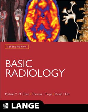 Chen M., Pope T., Ott D. Basic Radiology