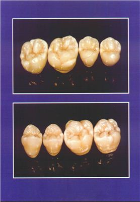 Копейкин В.Н. Атлас моделирования зубов