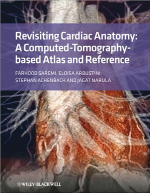 Saremi F., Arbustini E., Achenbach S., Narula J. Revisiting Cardiac Anatomy: A Computed-Tomography-Based Atlas