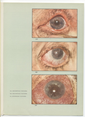Раднот М. Атлас глазных болезней. В двух томах. Том 2
