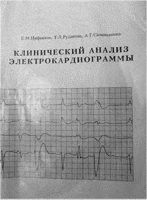 Нифонтов Е.М., Рудакова Т.Л., и др. Клинический анализ электрокардиограммы