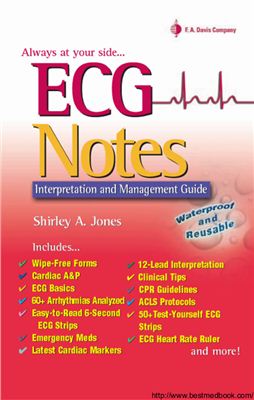 Shirley A. Jones. ECG Notes. Interpretation and Managment Guide