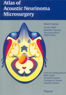 Sanna M. Atlas of Acoustic Neurinoma Microsurgery