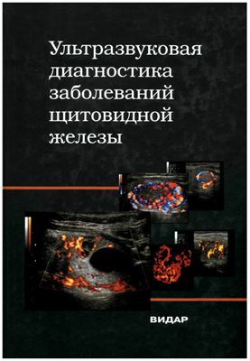 Харченко В.П. и др. Ультразвуковая диагностика заболеваний щитовидной железы