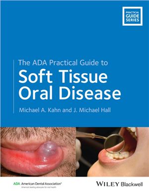 Kahn M.A., Hall J.M. The ADA Practical Guide to Soft Tissue Oral Disease