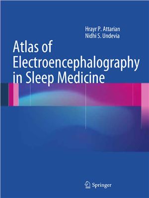 Attarian H.P., Undevia N.S. Atlas of Electroencephalography in Sleep Medicine