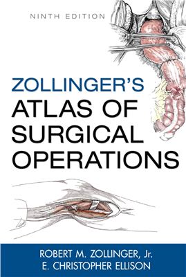 Zollinger R.M., Ellison E.C. Zollinger's Atlas of Surgical Operations