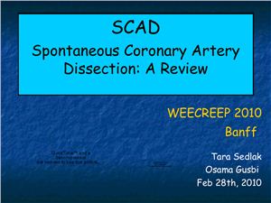 Презентация - Спонтанное расслоение коронарной артерии: обзор (на англ. языке)