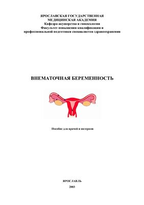 Хитров М.В., Охапкин М.Б., Ильяшенко И.Н. Внематочная беременность