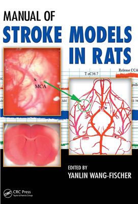 Manual of Stroke Models in Rats. Edited by Yanlin Wang-Fischer