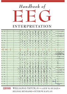Tatum W.O., Husain A.M., Benbadis S.R., Kaplan P.W. Handbook of EEG interpretation