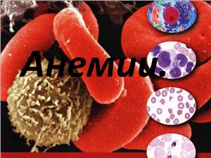 Реферат: Мегалобластные анемии