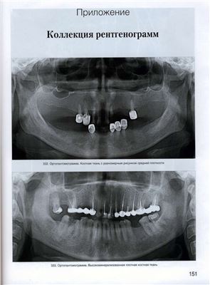 Рогацкин Д.В., Гинали Н.В. Искусство рентгенографии зубов. (Коллекция рентгенограмм)