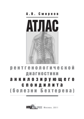 Смирнов А.В. Атлас рентгенологической диагностики анкилозирующего спондилита (болезни Бехтерева)