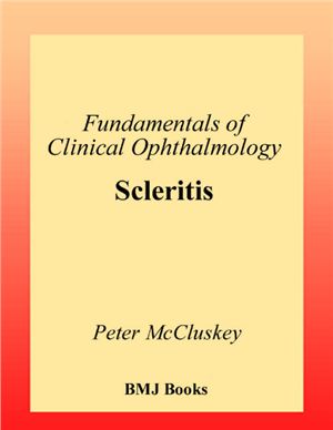 McCluskey Peter. Fundamentals of Clinical Ophthalmology. Scleritis