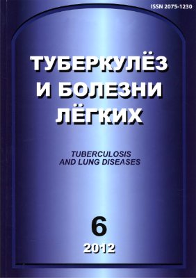 Туберкулез и болезни легких 2012 №06