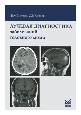 Китаев В.М., Китаев С.В. Лучевая диагностика заболеваний головного мозга