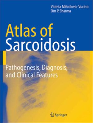 Mihailovic-Vucinic Violeta. Atlas of Sarcoidosis Pathogenesis, Diagnosis, and Clinical Features